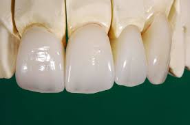 Sứ Ceramill ZI ZOLID